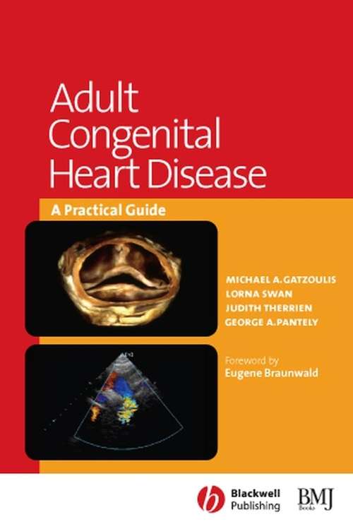 Book cover of Adult Congenital Heart Disease: A Practical Guide