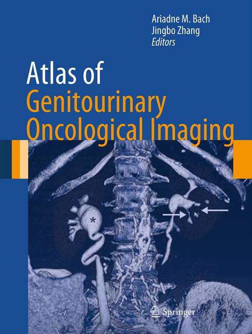 Book cover of Atlas of Genitourinary Oncological Imaging (2012) (Atlas of Oncology Imaging #1)
