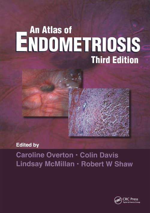 Book cover of Atlas of Endometriosis (3)