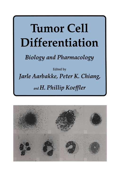 Book cover of Tumor Cell Differentiation: Biology and Pharmacology (1987) (Experimental Biology and Medicine #17)