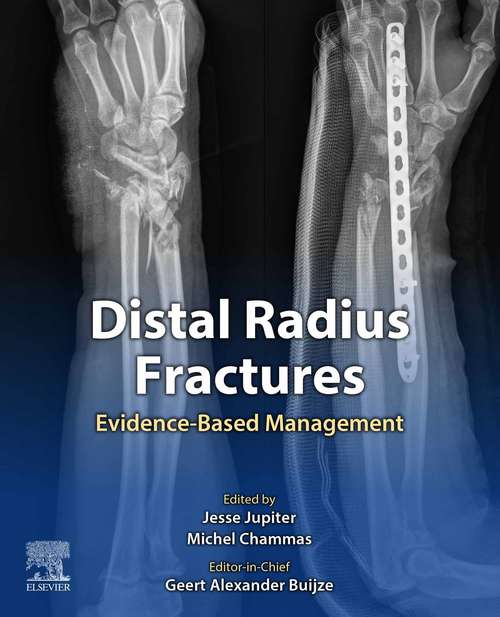 Book cover of Distal Radius Fractures: Evidence-Based Management (2)