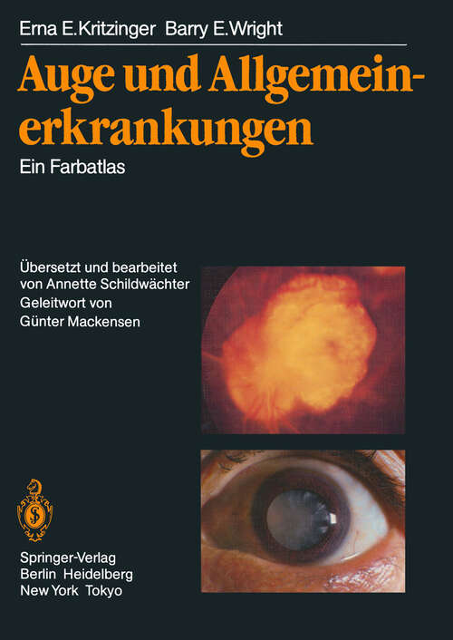 Book cover of Auge und Allgemeinerkrankungen: Ein Farbatlas (1985)