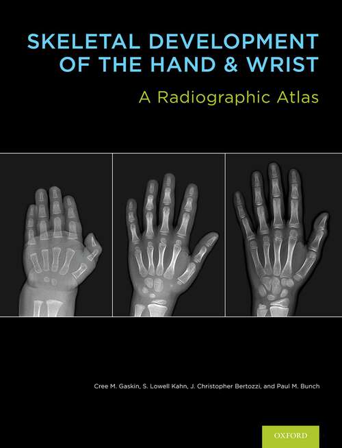 Book cover of Skeletal Development of the Hand and Wrist: A Radiographic Atlas and Digital Bone Age Companion