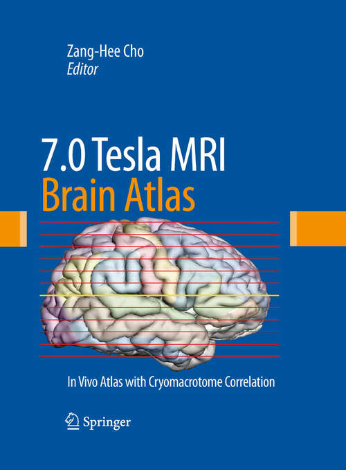 Book cover of 7.0 Tesla MRI Brain Atlas: In Vivo Atlas with Cryomacrotome Correlation (2010)