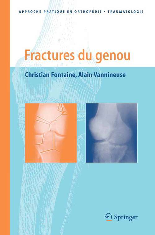 Book cover of Fractures du genou (2005) (Approche pratique en orthopédie-traumatologie)