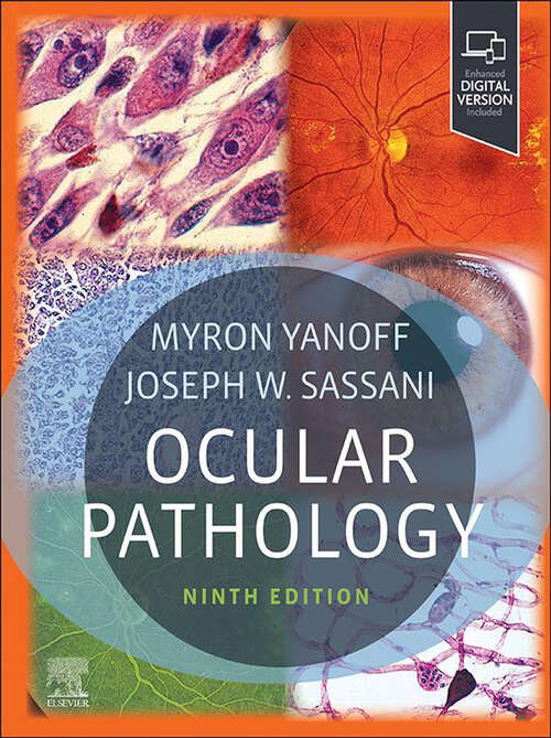 Book cover of Ocular Pathology - E-Book: Expert Consult (7)