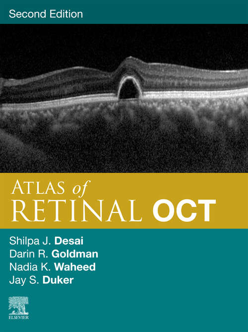 Book cover of Atlas of Retinal OCT E-Book: Optical Coherence Tomography