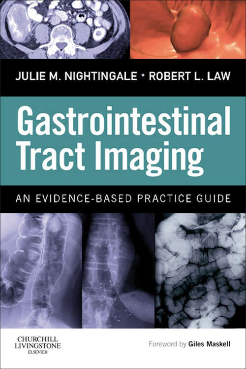 Book cover of Gastrointestinal Tract Imaging E-Book: An Evidence-Based Practice Guide