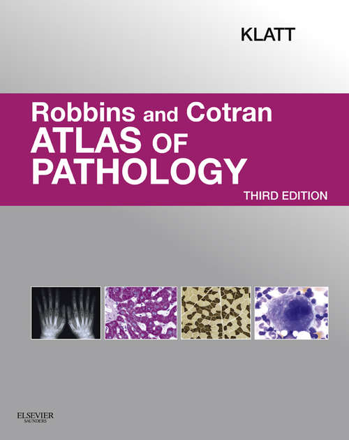 Book cover of Robbins and Cotran Atlas of Pathology E-Book: Robbins And Cotran Atlas Of Pathology (2) (Robbins Pathology)