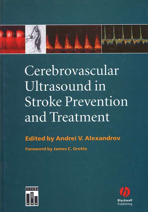Book cover of Cerebrovascular Ultrasound in Stroke Prevention and Treatment
