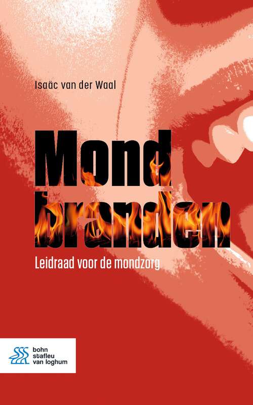 Book cover of Mondbranden: Leidraad voor de mondzorg (2nd ed. 2022)