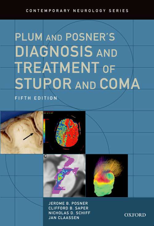 Book cover of Plum and Posner's Diagnosis and Treatment of Stupor and Coma (Contemporary Neurology Series)