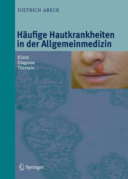Book cover of Häufige Hautkrankheiten in der Allgemeinmedizin: Klinik, Diagnose, Therapie (2010)