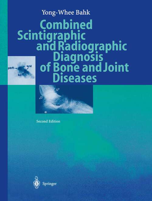 Book cover of Combined Scintigraphic and Radiographic Diagnosis of Bone and Joint Diseases (2nd ed. 2000)