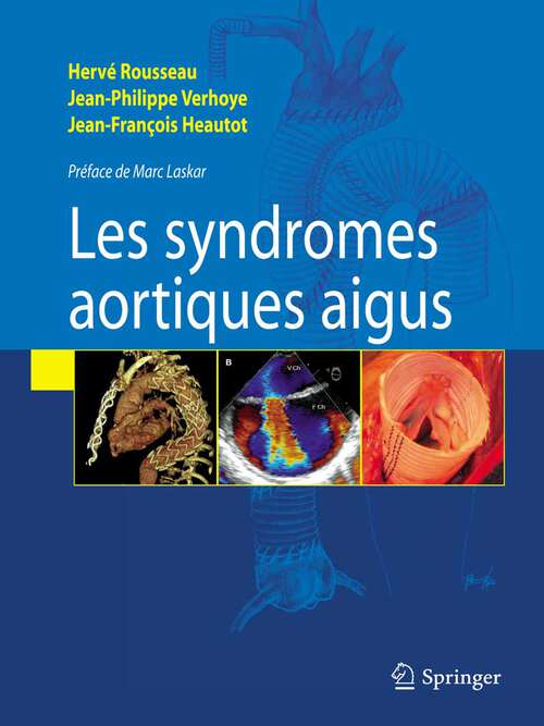 Book cover of Syndromes aortiques aigus: Aspects Modernes De La Physiopathologie, Du Diagnostic Et Du Traitement (2009)