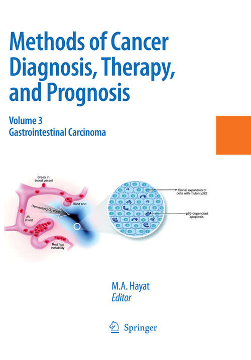 Book cover of Methods of Cancer Diagnosis, Therapy and Prognosis: Gastrointestinal Cancer (2009) (Methods of Cancer Diagnosis, Therapy and Prognosis #3)