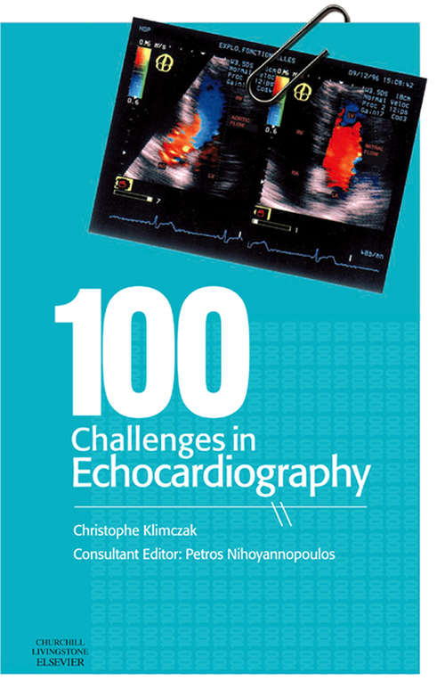 Book cover of 100 Challenges in Echocardiography E-Book