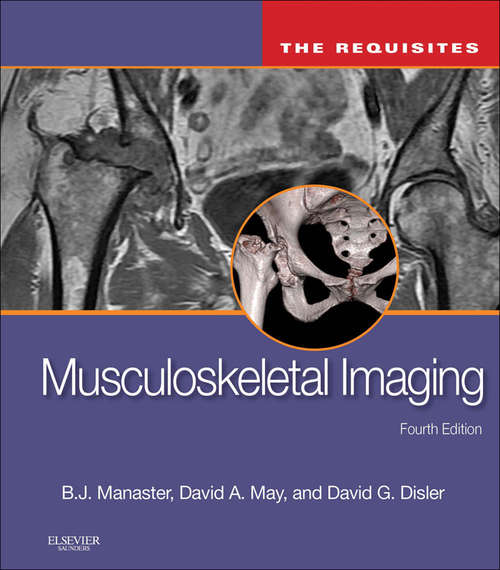 Book cover of Musculoskeletal Imaging: Musculoskeletal Imaging : The Requisites (4th Edition) (Requisites in Radiology)