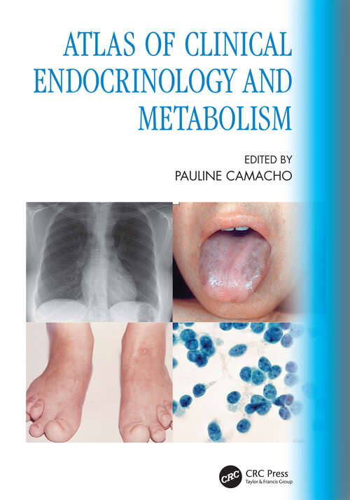 Book cover of Atlas of Clinical Endocrinology and Metabolism