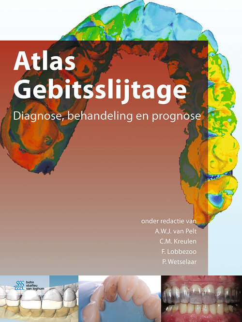 Book cover of Atlas Gebitsslijtage (1st ed. 2018)