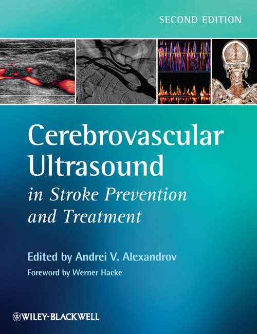 Book cover of Cerebrovascular Ultrasound in Stroke Prevention and Treatment (2)