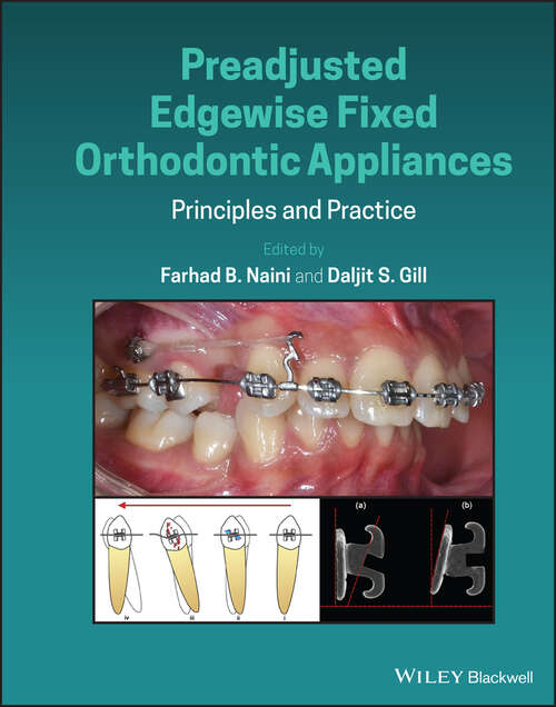 Book cover of Preadjusted Edgewise Fixed Orthodontic Appliances: Principles and Practice