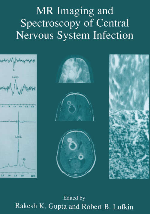 Book cover of MR Imaging and Spectroscopy of Central Nervous System Infection (2001)