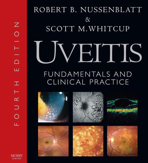 Book cover of Uveitis E-Book: Fundamentals and Clinical Practice (4)