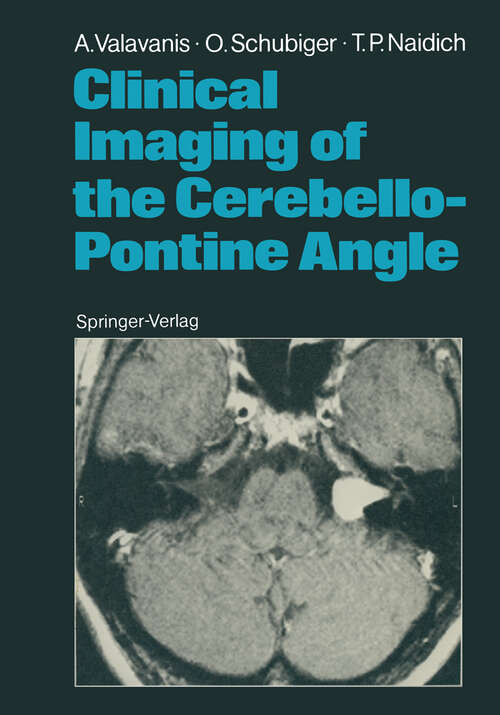 Book cover of Clinical Imaging of the Cerebello-Pontine Angle (1987)