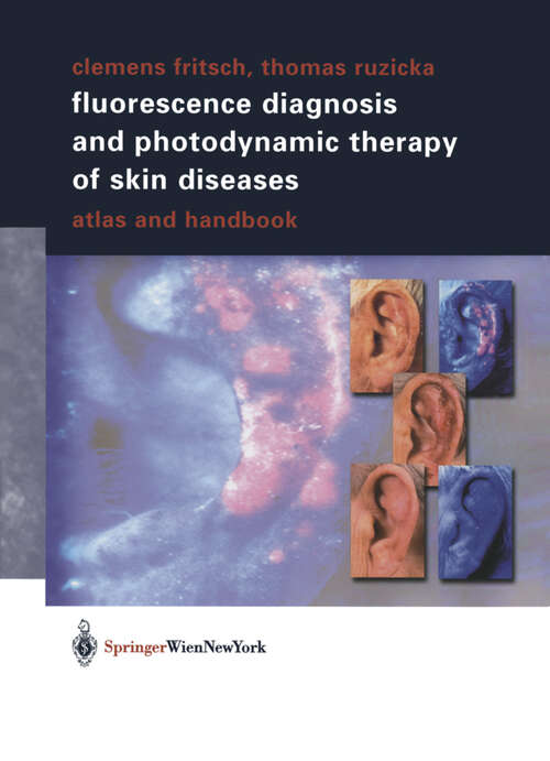 Book cover of Fluorescence Diagnosis and Photodynamic Therapy of Skin Diseases: Atlas and Handbook (2003)
