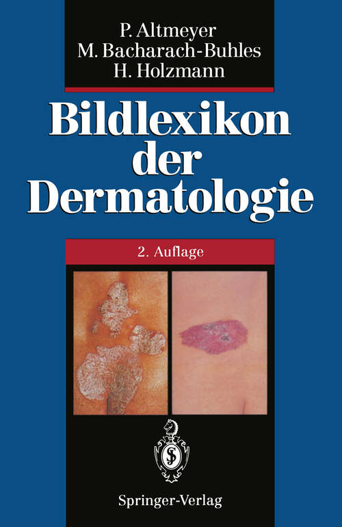 Book cover of Bildlexikon der Dermatologie (2. Aufl. 1995)