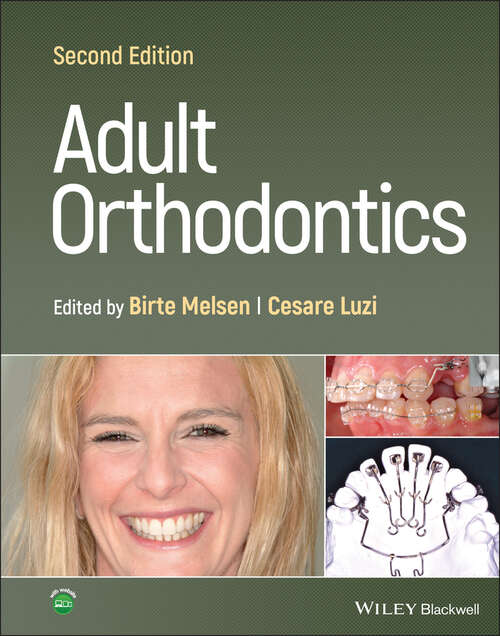 Book cover of Adult Orthodontics (2)