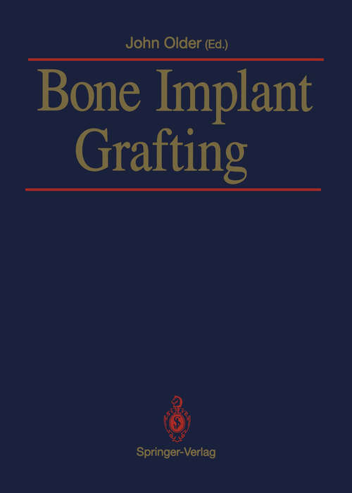 Book cover of Bone Implant Grafting (1992)