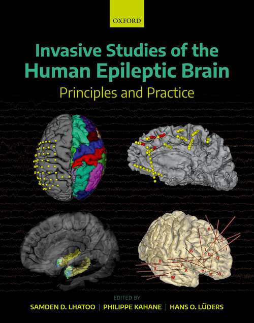 Book cover of Invasive Studies of the Human Epileptic Brain: Principles and Practice