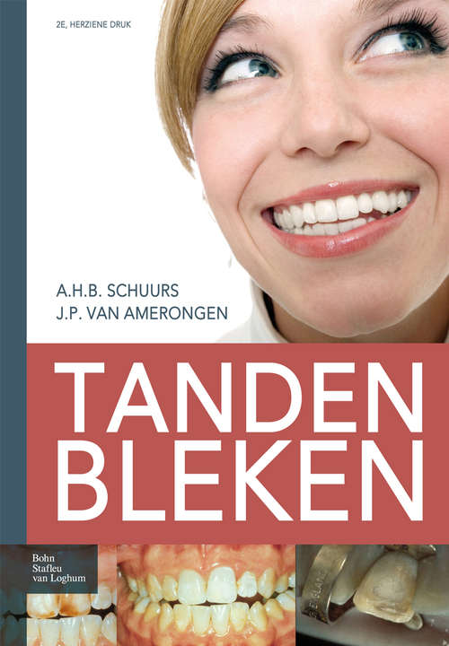 Book cover of Tanden bleken (2nd ed. 2009)