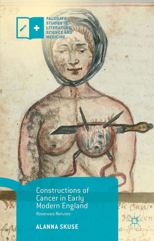 Book cover of Constructions of Cancer in Early Modern England: Ravenous Natures (1st ed. 2015) (Palgrave Studies in Literature, Science and Medicine)