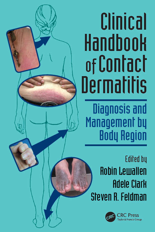 Book cover of Clinical Handbook of Contact Dermatitis: Diagnosis and Management by Body Region