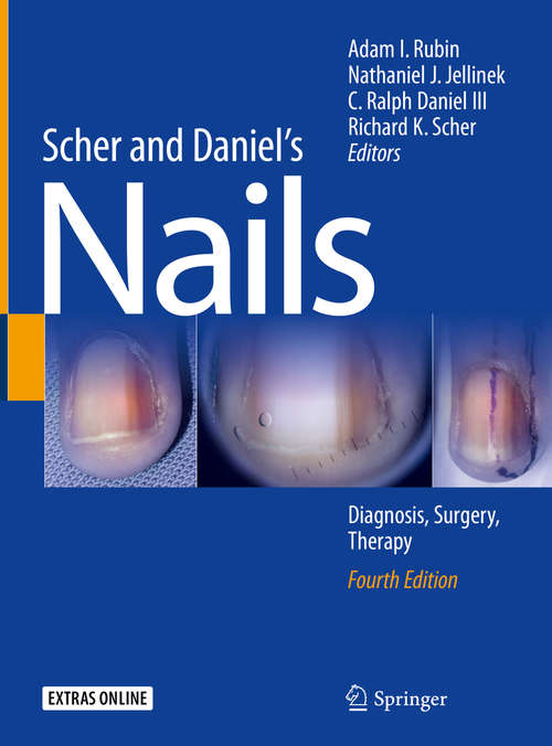 Book cover of Scher and Daniel's Nails: Diagnosis, Surgery, Therapy