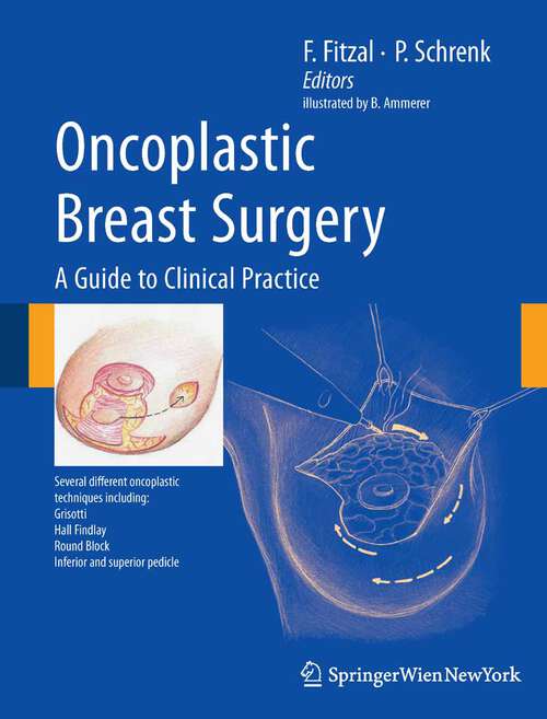 Book cover of Oncoplastic Breast Surgery: A Guide to Clinical Practice (2010)