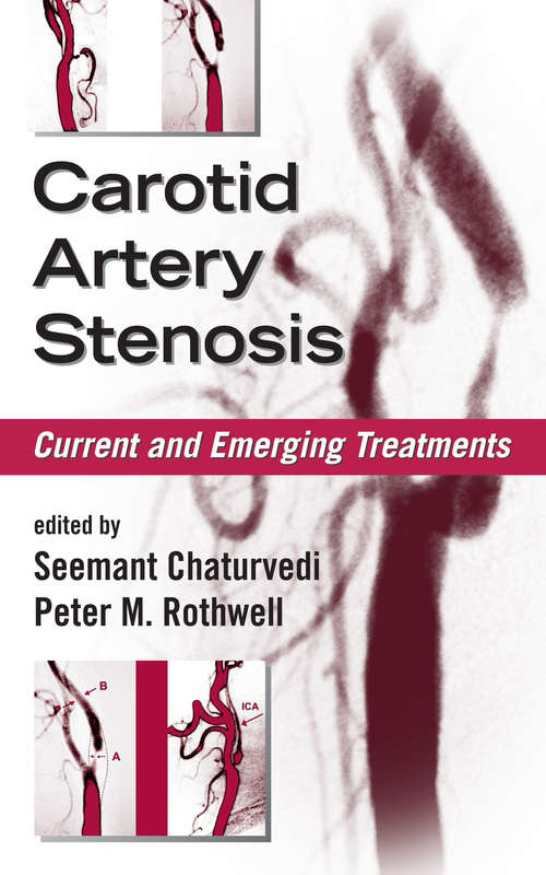 Book cover of Carotid Artery Stenosis: Current and Emerging Treatments (Neurological Disease And Therapy Ser.)