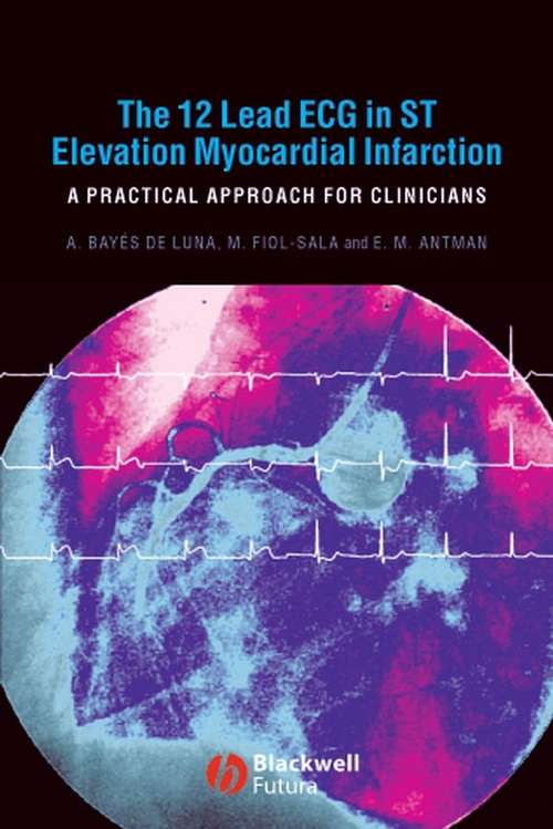Book cover of The 12 Lead ECG in ST Elevation Myocardial Infarction: A Practical Approach for Clinicians