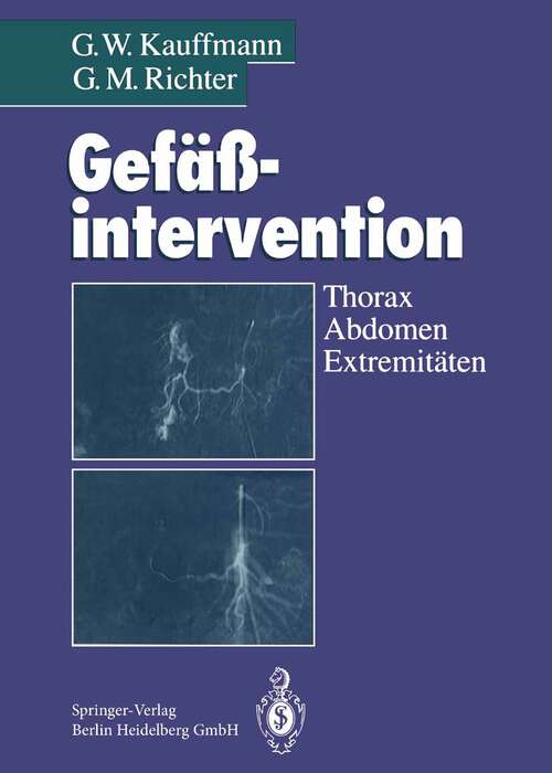 Book cover of Gefäßintervention: Thorax, Abdomen, Extremitäten (1994)