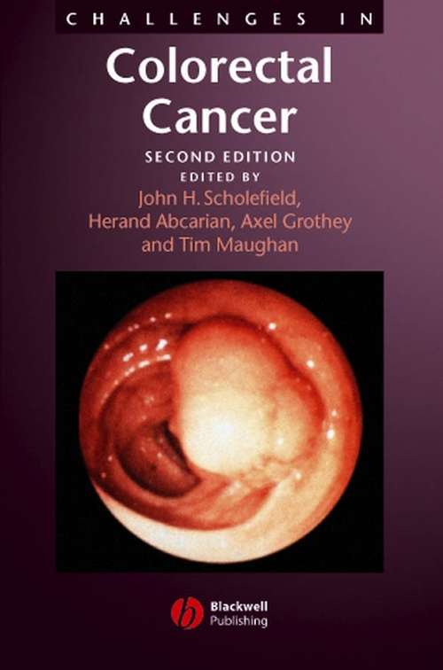 Book cover of Challenges in Colorectal Cancer (2)