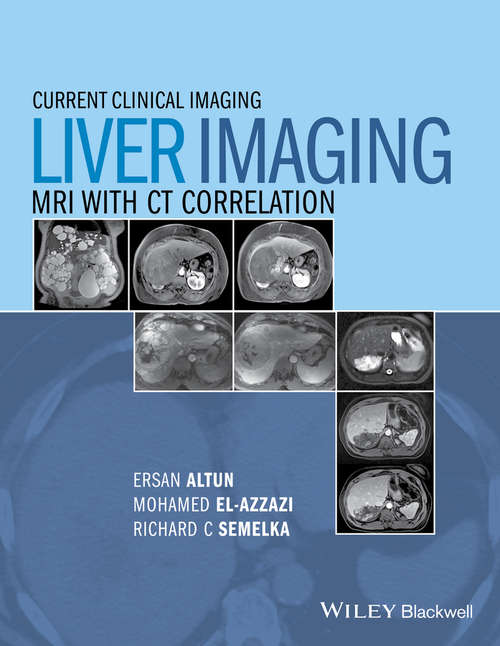 Book cover of Liver Imaging: MRI with CT Correlation (Current Clinical Imaging)
