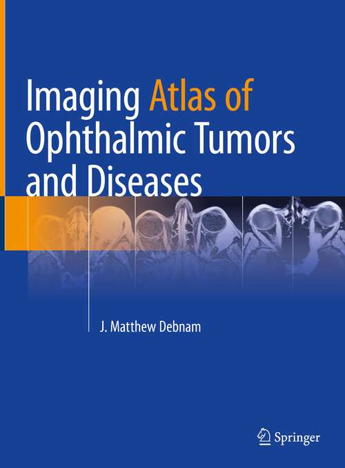 Book cover of Imaging Atlas of Ophthalmic Tumors and Diseases (1st ed. 2023)