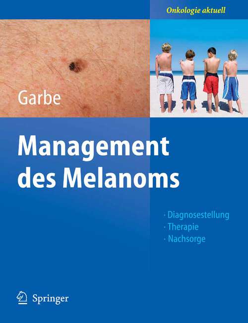 Book cover of Management des Melanoms (2006) (Onkologie aktuell)