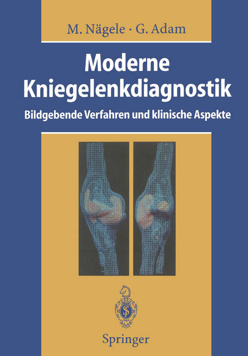 Book cover of Moderne Kniegelenkdiagnostik: Bildgebende Verfahren und klinische Aspekte (1995)