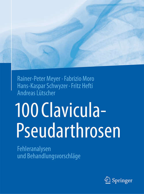 Book cover of 100 Clavicula-Pseudarthrosen: Fehleranalysen und Behandlungsvorschläge (1. Aufl. 2018)