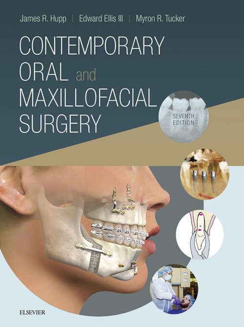 Book cover of Contemporary Oral and Maxillofacial Surgery E-Book: Contemporary Oral and Maxillofacial Surgery E-Book (7)