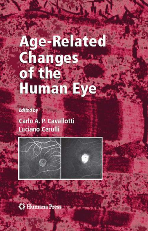Book cover of Age-Related Changes of the Human Eye (2008) (Aging Medicine)